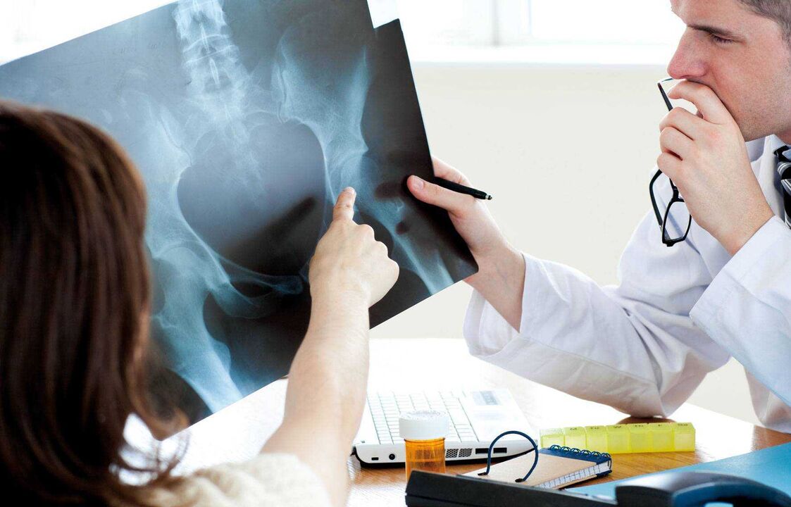doctors examining x-ray for osteoarthritis of the hip